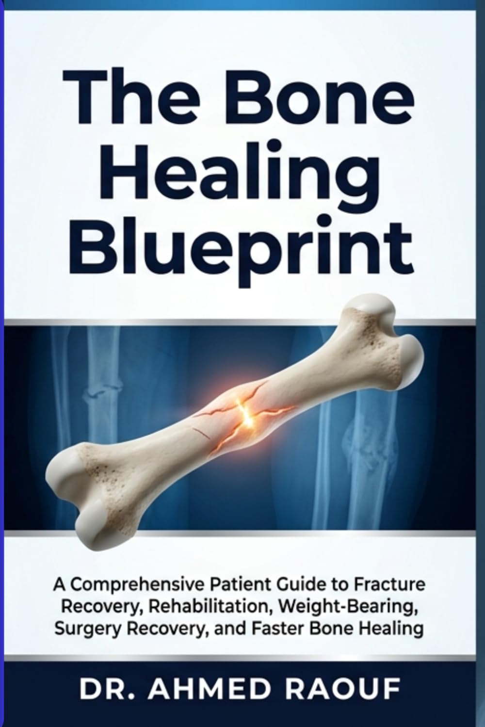 The Bone Healing Blueprint: A Comprehensive Patient Guide to Fracture Recovery, Rehabilitation, Weight-Bearing, Surgery Recovery, and Faster Bone Healing (Orthopaedic Surgery Patient Guides)