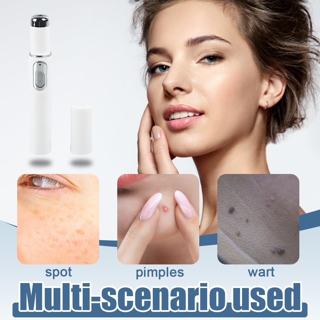 1 Stück Blaulicht Stift Mole Removal Pen für Reduziert Narben Augenringe Schwellungen und Falten