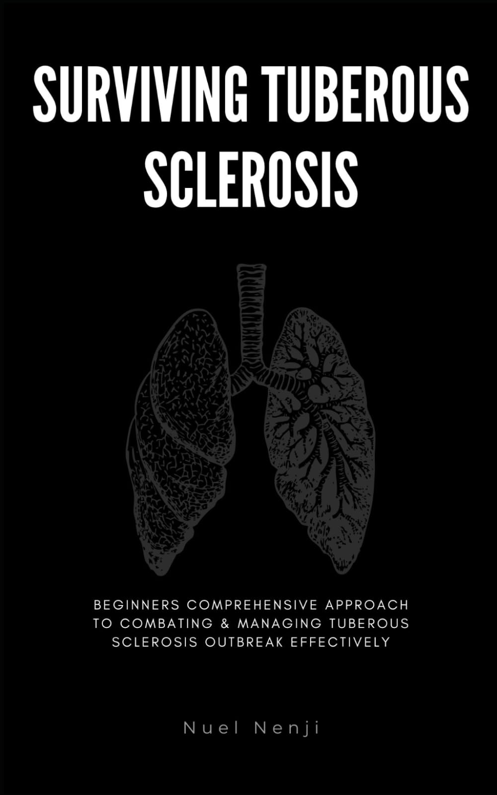 SURVIVING TUBEROUS SCLEROSIS: Beginners Comprehensive Approach To Combating & Managing Tuberous Sclerosis Outbreak Effectively