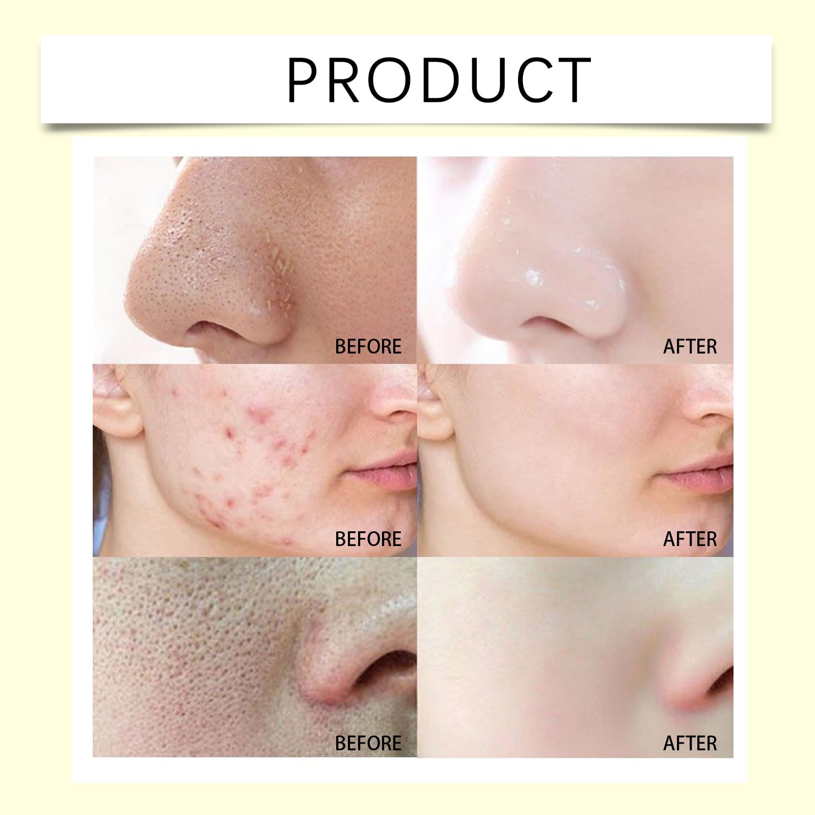 Exfoliante facial con vitamina C y cúrcuma, exfoliante de cúrcuma para el rostro, exfoliante facial blanqueador con vitamina C, con sal marina, limpieza profunda de los poros de la suciedad, todo tipo