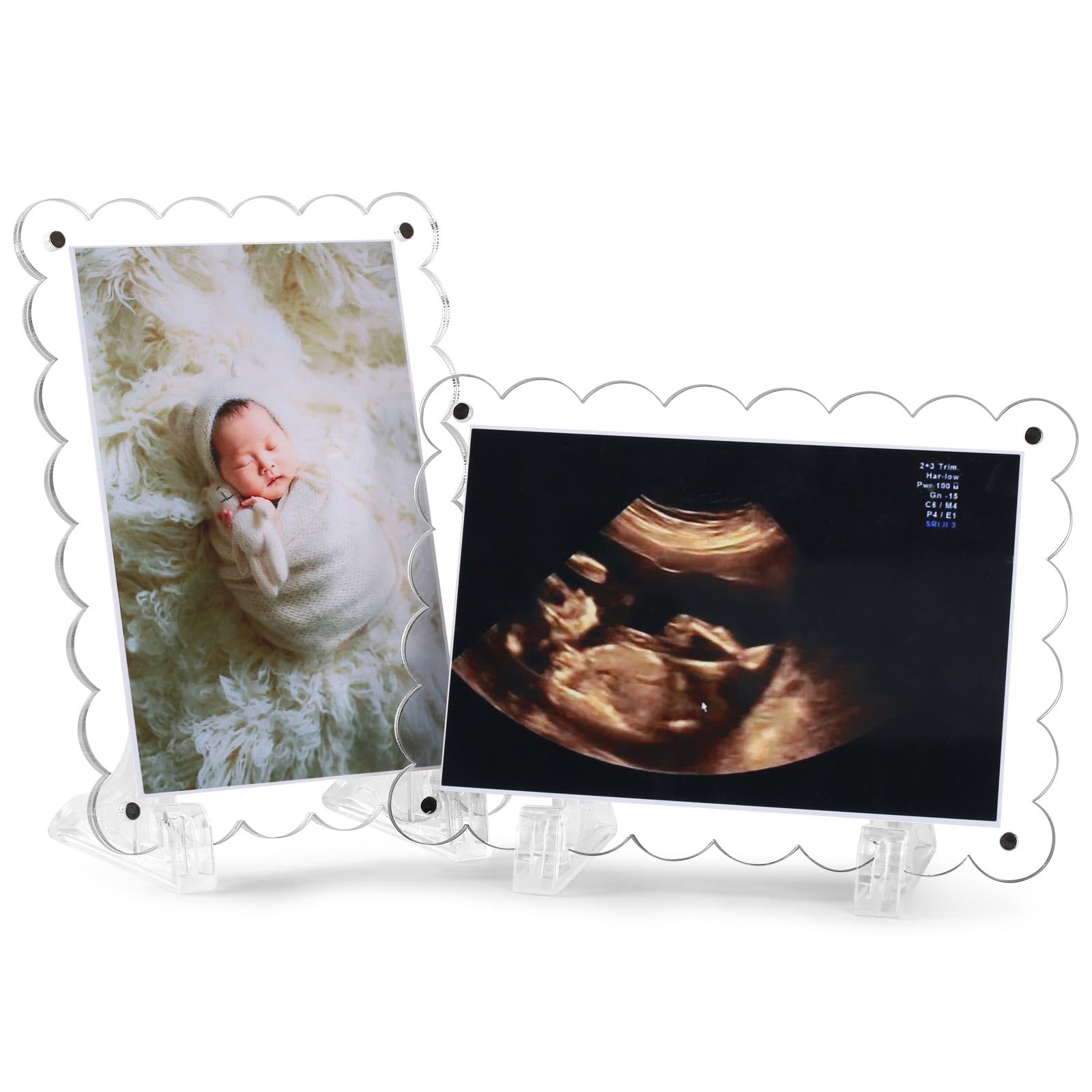 2 Pack Magnetic Clear Acrylic Scalloped Ultrasound Picture Frames with Stand - Horizontal & Vertical Sonogram Display for Pregnancy Announcement, Gender Reveal - Dual Sided Keepsake for New Parents
