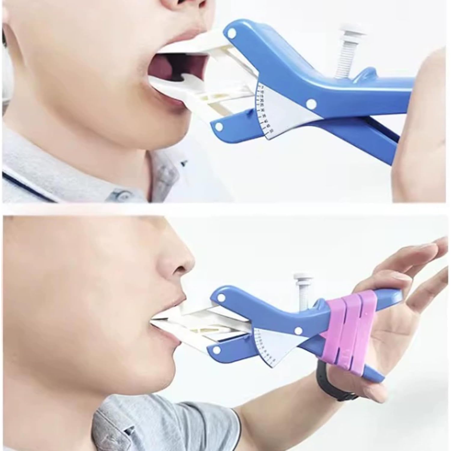 Flaring Mouth Opener, Mundöffner Aus Silikon, Zahnärztlicher Wangenretraktor, Einstellbarer Öffnungsabstand Von 7–50 Mm, Mit Durchsichtiger Winkelplatte, Für Die Mundpflege