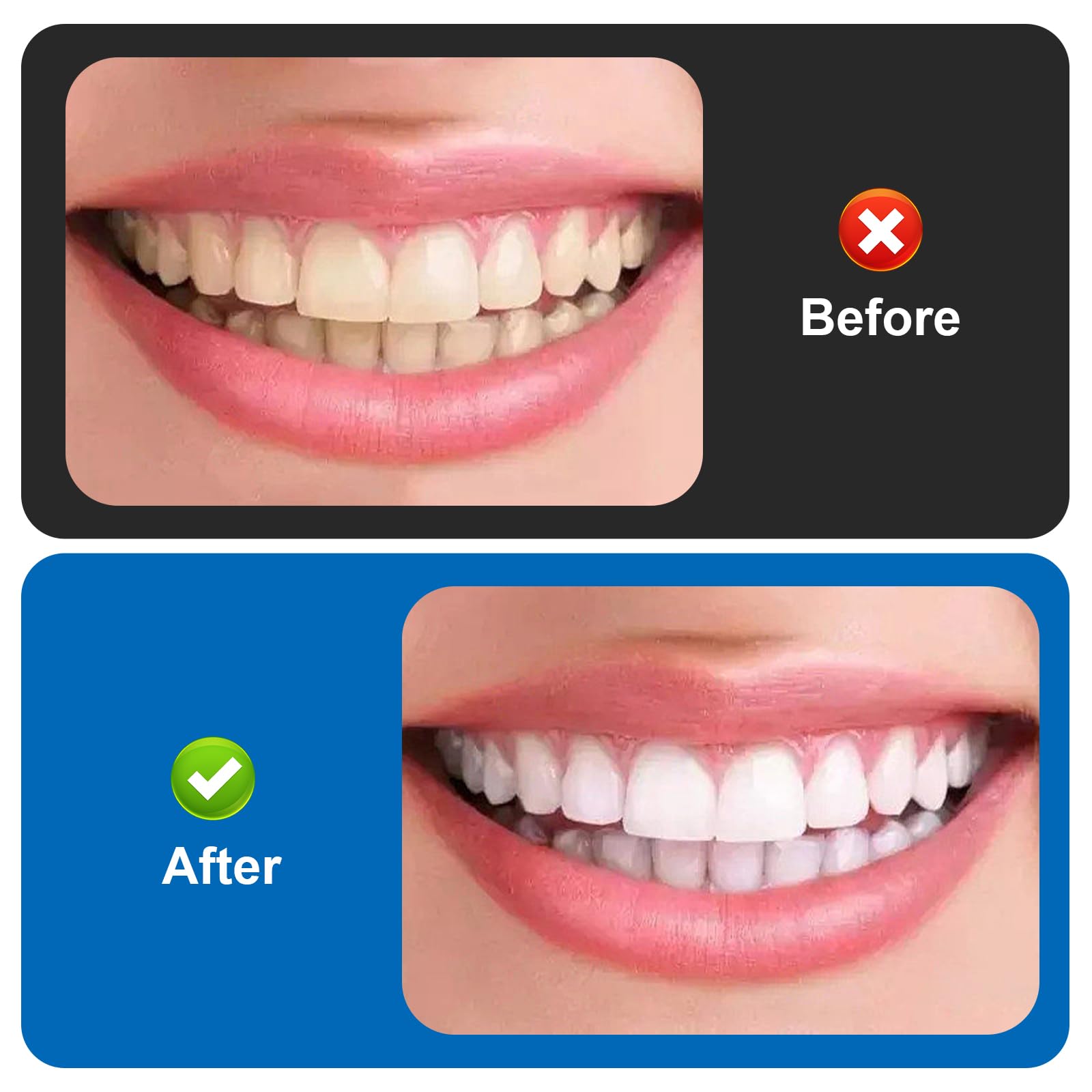 Szczotki międzyzębowe 100 szt. narzędzi do czyszczenia dentystycznego, kostki do nici dentystycznej, wykałaczki do higieny jamy ustnej, nitkownica, higiena jamy ustnej, wykałaczki, narzędzie do