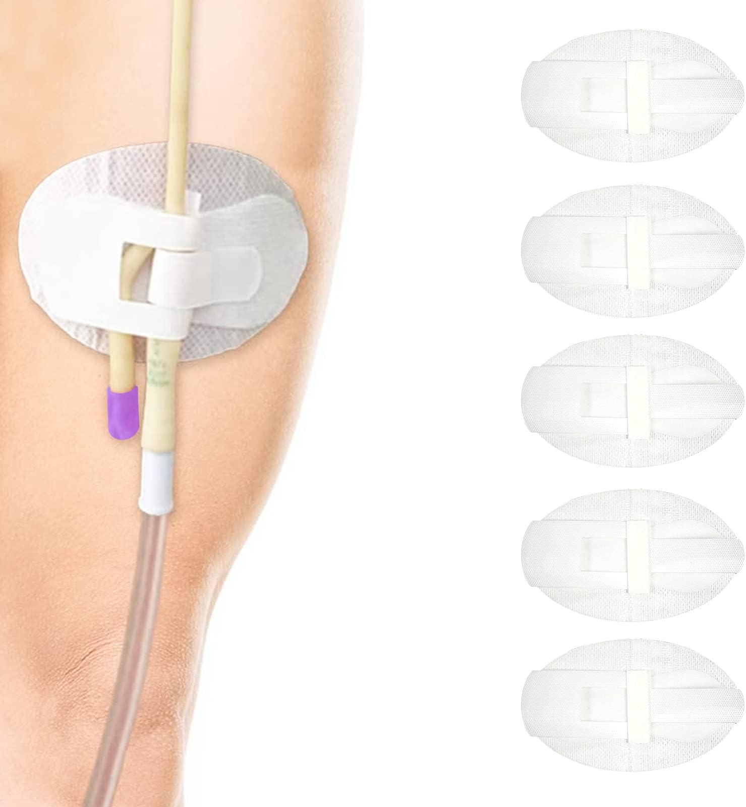 – 5Pcs Catheter HoldeCatheter Stabilization Device Legband Holder Sticker Urinary Tube Holder Universal Fixing Bands Catheter Tube Holder White (White-5Pcs)