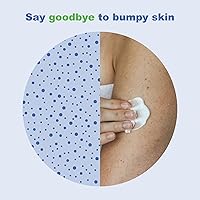 Vista 3 de KP Elements, Crema de tratamiento para la queratosis capilar, Crema para la queratosis capilar para brazos y muslos, Alivia el enrojecimiento