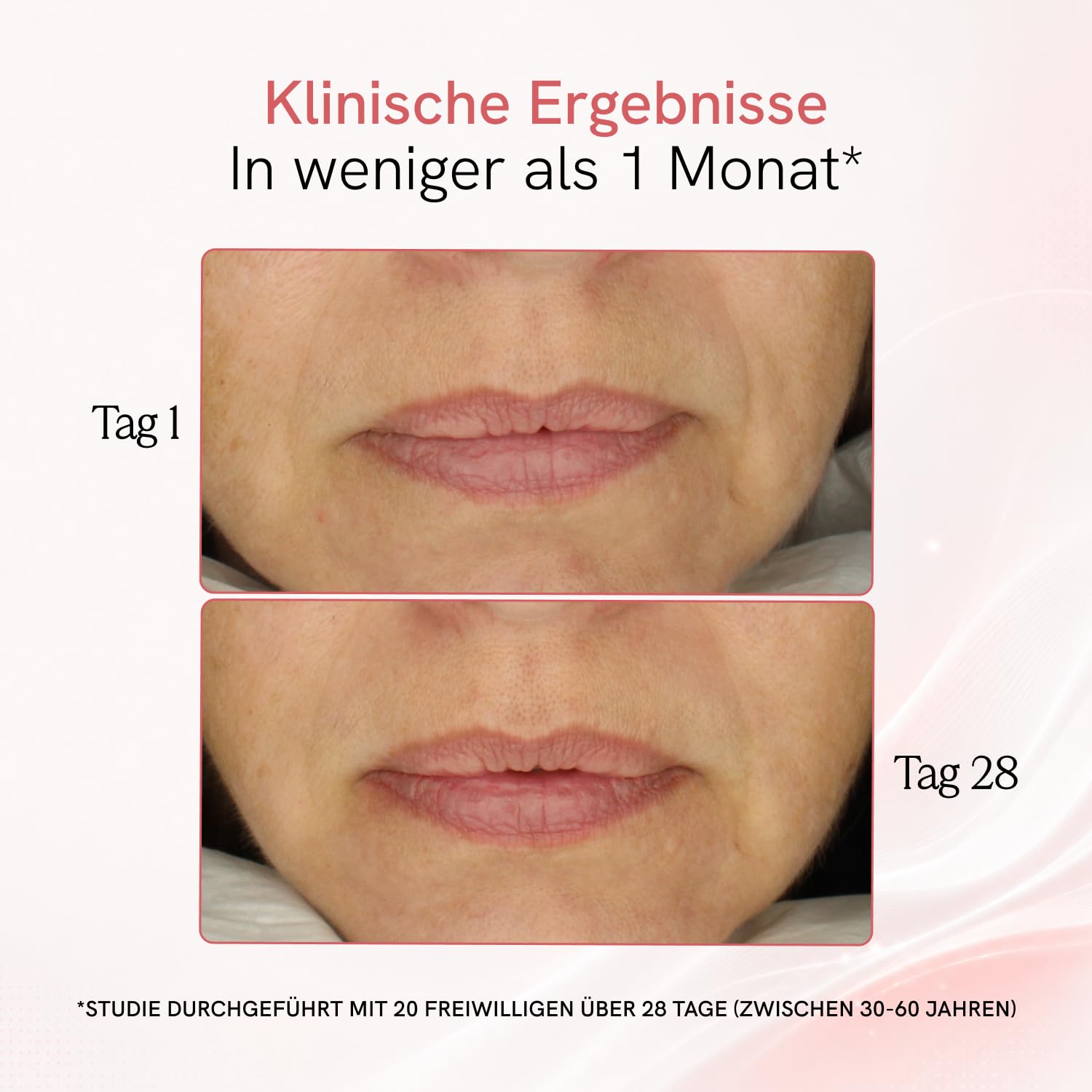 MASDERM | Professionelles 5-in-1 Radiofrequenz-Gesichtsgerät | Ultraschall für das Gesicht | Gesichtsmassagegerät | Anti-Falten-Gerät | straffende Galvanik Gesicht | Hohe Frequenz | Hochfrequenz