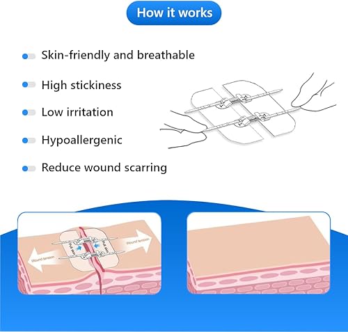 Miniatura 6 de Cierres de heridas de emergencia 10 unidades de dispositivo de cierre de heridas con cremallera, suturas sin dolor, reparación de laceración sin