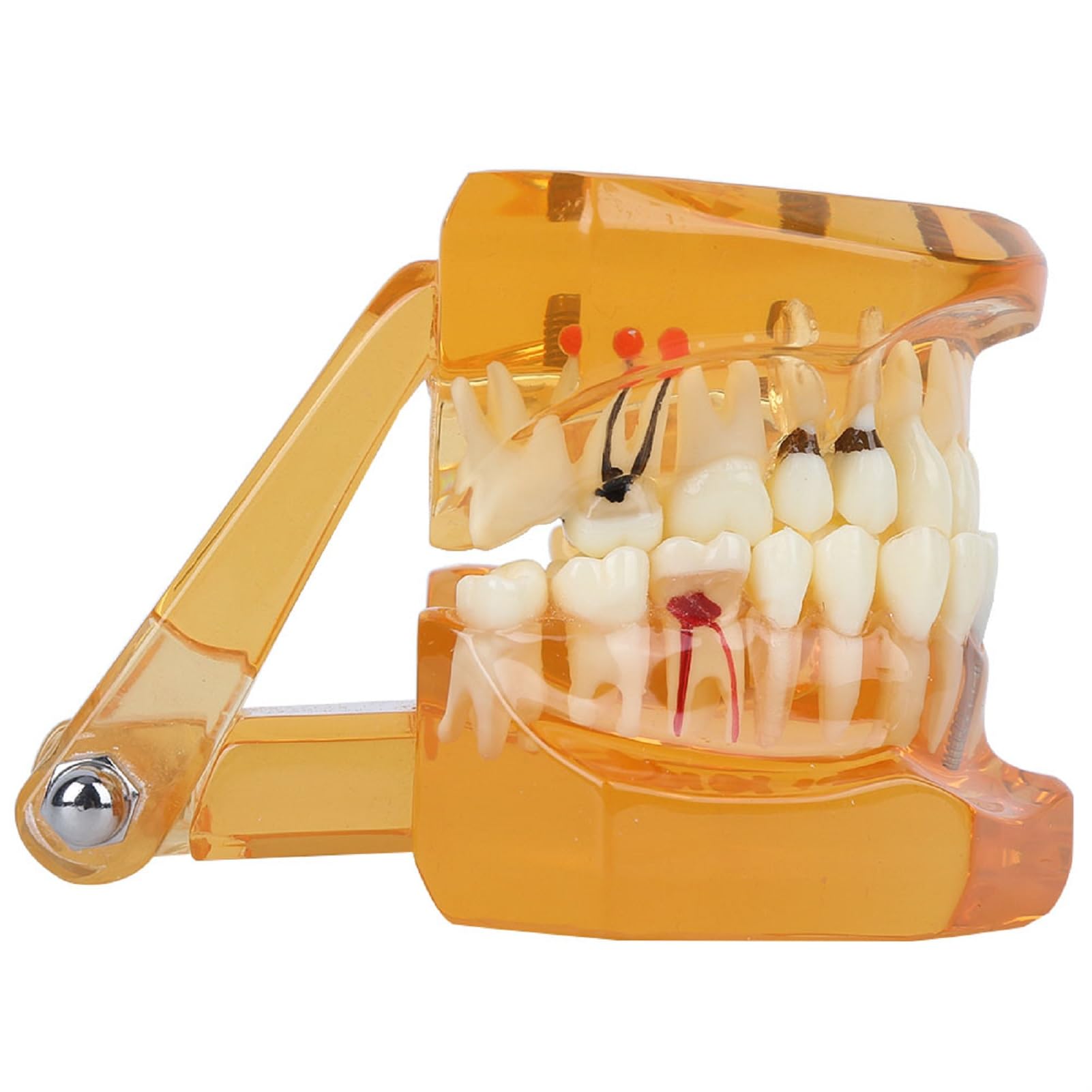 Modelo de Estudio de Dientes Dentales Extraíbles para Enseñanza Demostración Sobredentadura Maxilar Clínica Laboratorio Dentista