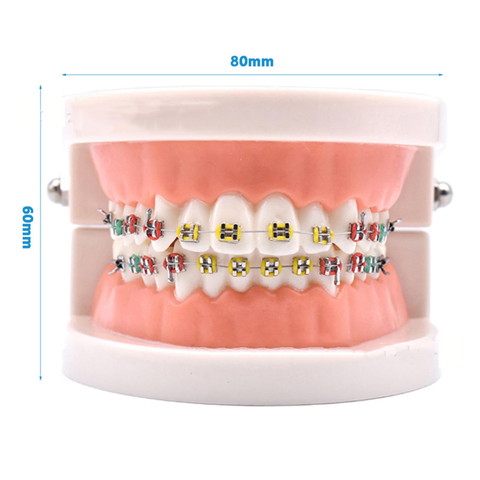Modello dimostrativo ortodontico Dentale con Attacco Metallico Standard per Il Trattamento dei Denti, Modello di insegnamento, Studio e spiegazione
