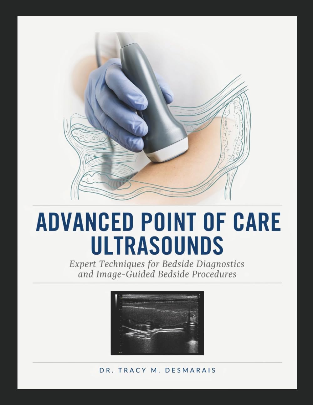 ADVANCED POINT OF CARE ULTRASOUNDS: Expert Techniques for Bedside Diagnostics and Image-Guided Bedside Procedures