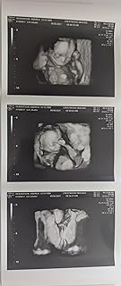 Prank 3D Customized Fake Ultrasound Strip of 3 Photos