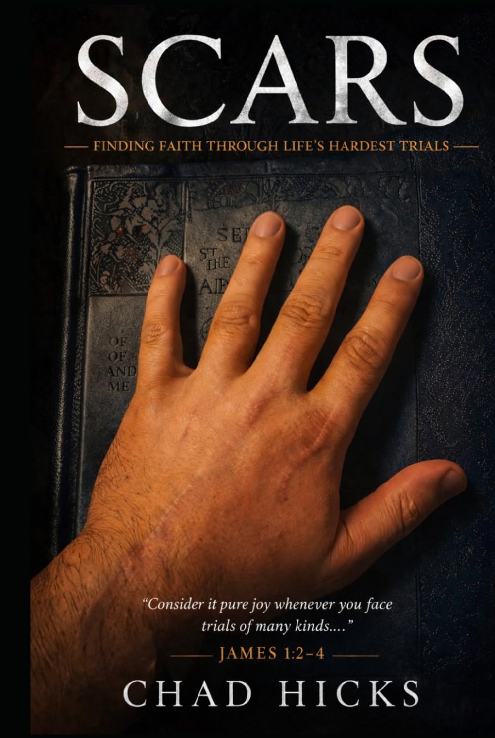 SCARS: FINDING FAITH THROUGH LIFE'S HARDEST TRIALS
