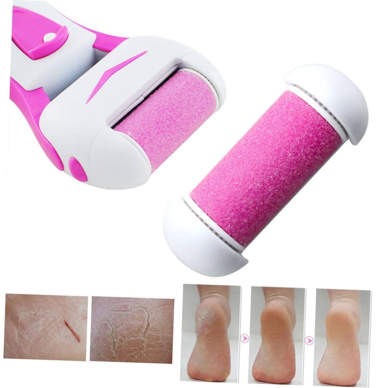 minkissy 30piezas Rodillos De Reemplazo Para Exfoliador De Pies Eliminador De Muerta y Durezas Herramienta De Cuidado De Pies Color Rosa
