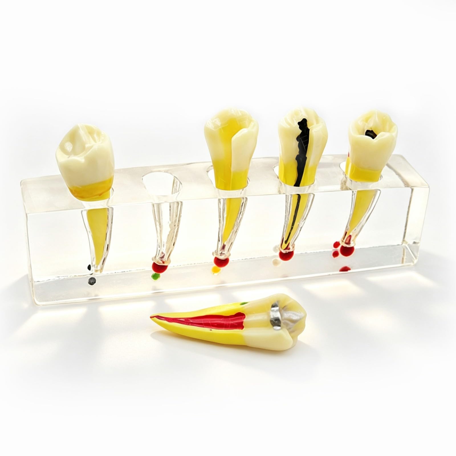 Modèle d'implant dentaire pour l'éducation du patient, modèle de traitement endodontique/démonstration d'anatomie canalaire, modèles de dents pédagogiques pour la démonstration
