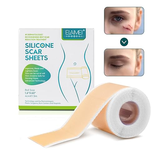 Cinta de silicona para cicatrices hojas parches tratamiento de eliminación de cicatrices tiras profesionales para cirugía csección queloide