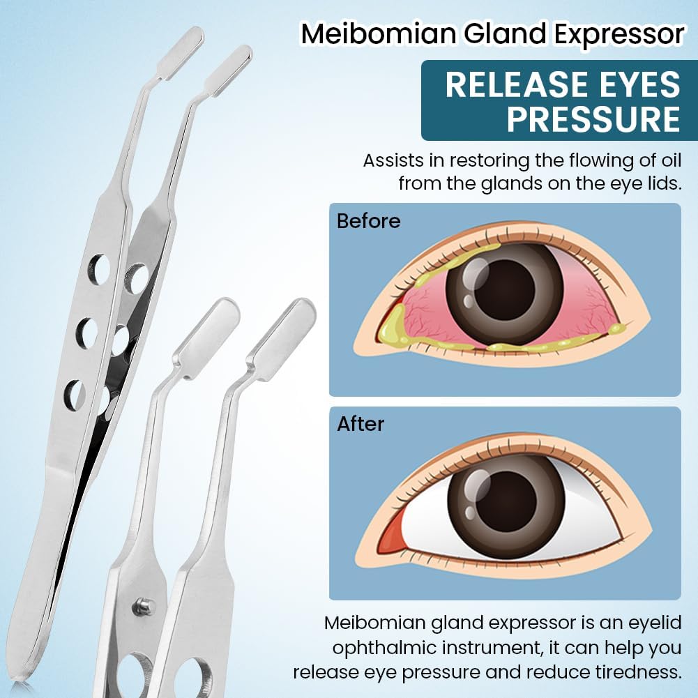 Meibomian Gland Expressor, Stainless Steel Eyelid Massage Tweezers, Professional Forceps Dryeye Extraction Tool for Men Women, Eye Care Tool For Dry Eyes(Square Tip,SIZE:3 * 10)
