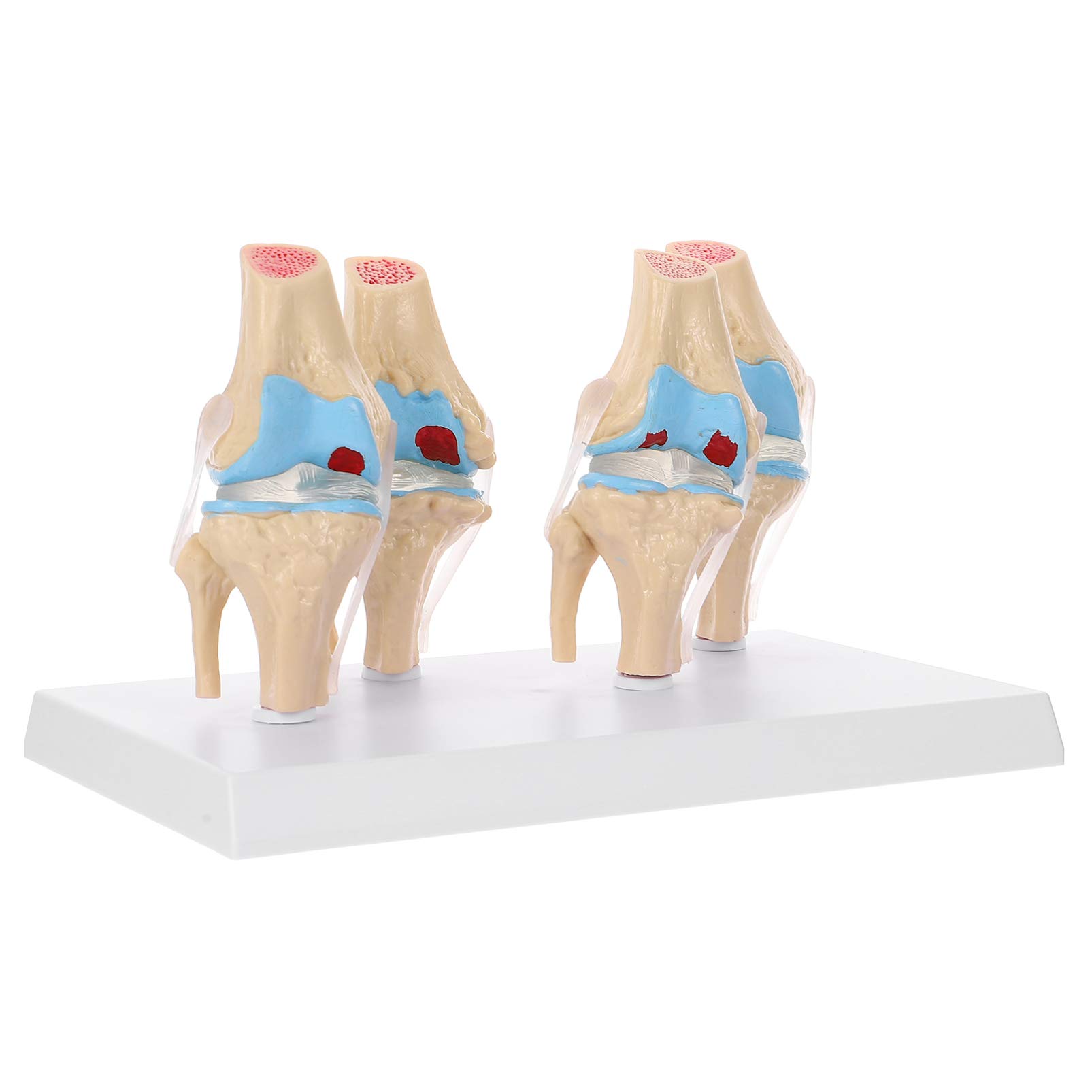 Buy Hemobllo Knee Joint Model Set Human Body Anatomy Replica Set of 4 ...