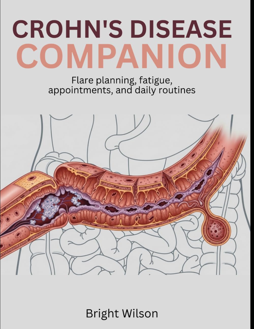 Crohn’s Disease Companion: Flare planning, fatigue, appointments, and daily routines