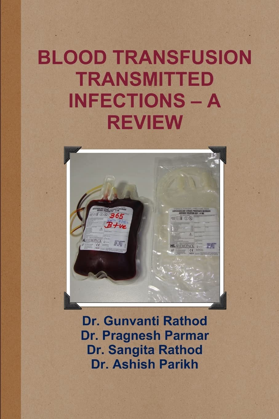 BLOOD TRANSFUSION TRANSMITTED INFECTIONS – A REVIEW