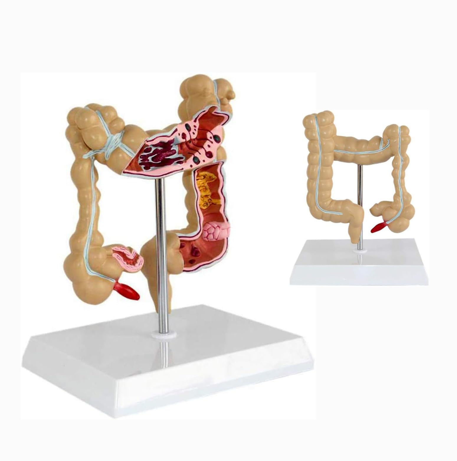 Model patologicznej zmiany jelita grubego człowieka, naturalnie duże narzędzie do nauczania anatomii do edukacji medycznej i treningu klinicznego
