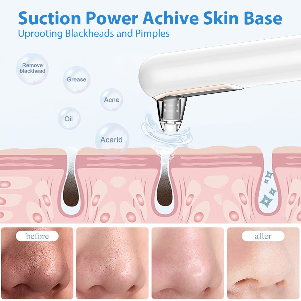 Yccu Aspirateur Point Noir Extracteur de Comédons Nettoyage des Pores Purateur de Peau Visage 4 Sondes et 4 Modes d'extraction des Points Noirs Rechargeable