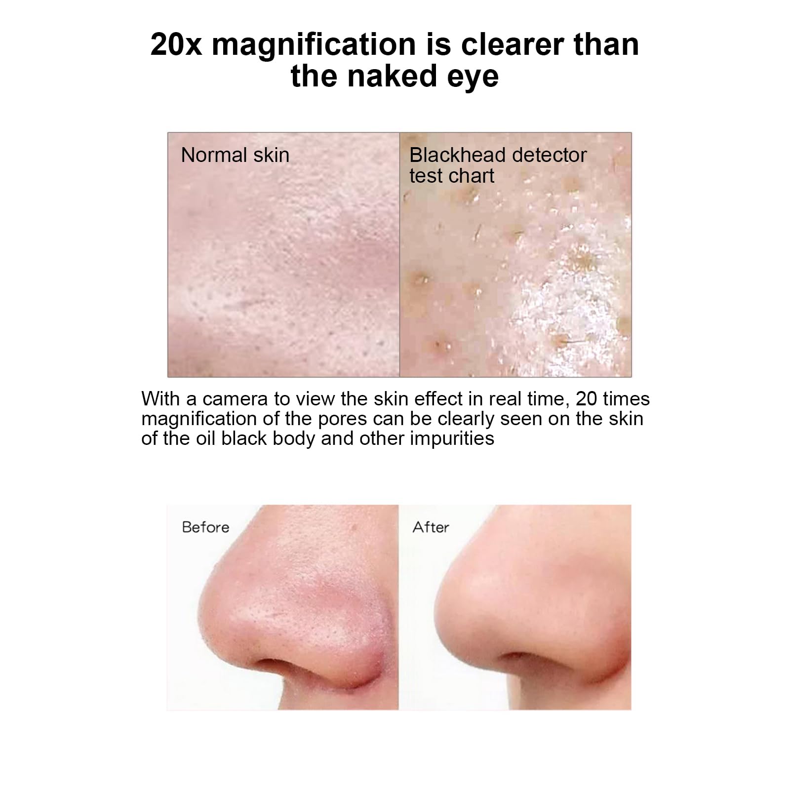 Misuratore elettrico per rimuovere punti neri e acne, 200 W, pixel, regolazione a 6 velocità, pulizia profonda del viso con 4 testine di aspirazione
