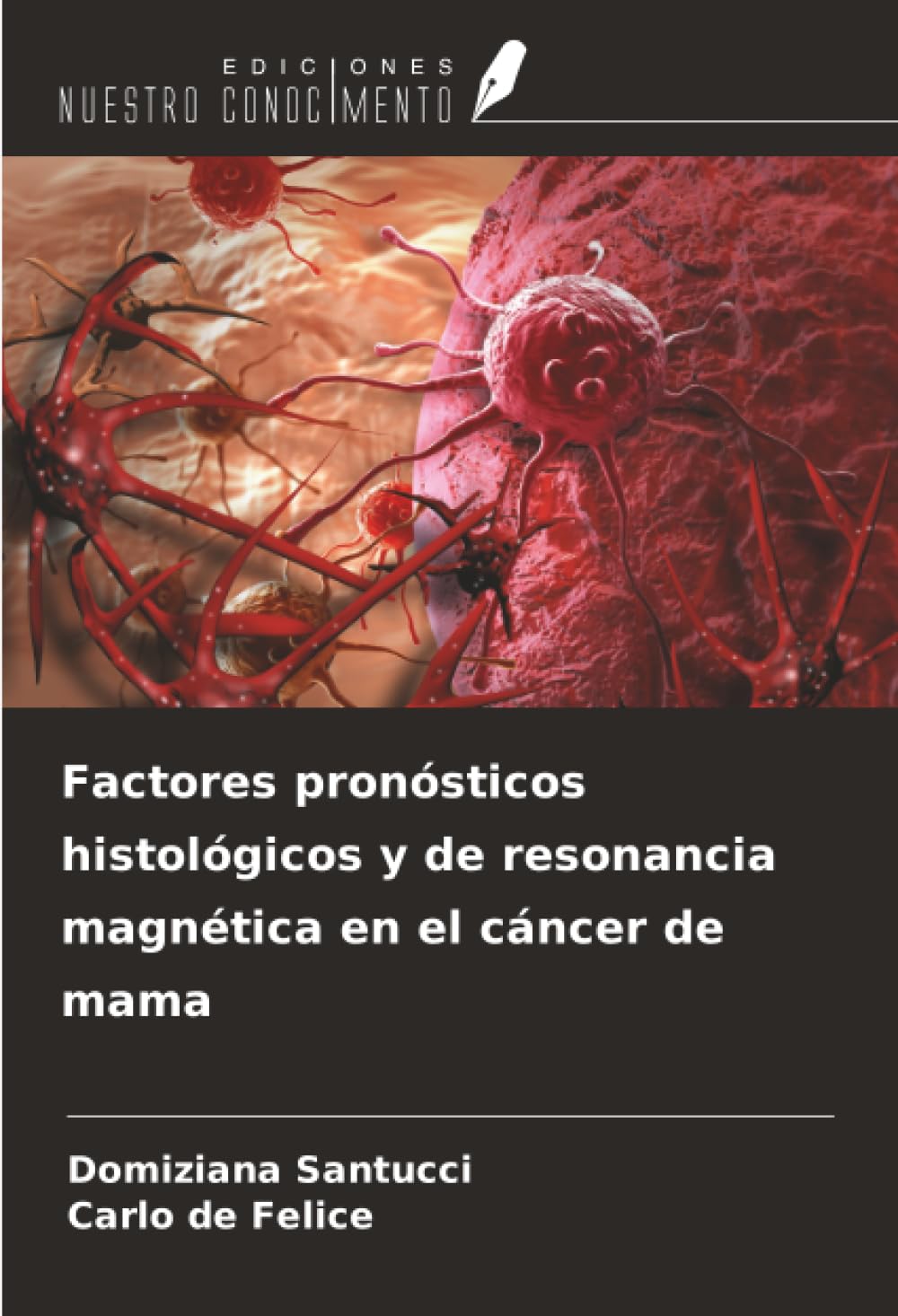 Factores pronósticos histológicos y de resonancia magnética en el cáncer de mama
