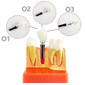 健康・医学 Implant Dentistry: Theory and Practice IMPLANT DENTISTRY THEORY AND PRACTICE (Dental Science