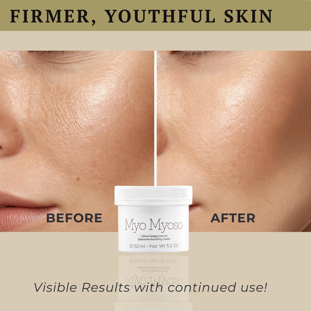 Amazon.com: Gernetic MYO MYOSO Intensive Smoothing Cream, Intense