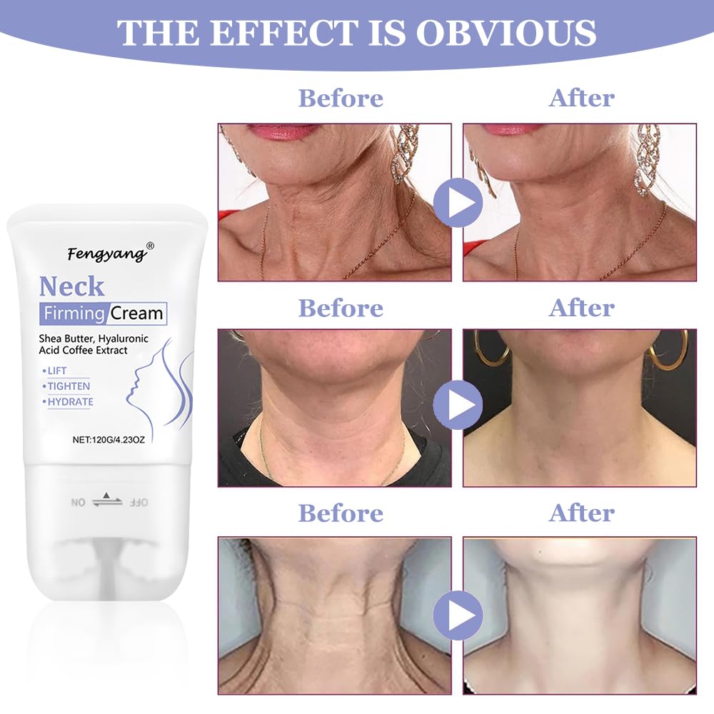Fengyang® Neck Firming Cream,Neck Collagen Cream with Massage Roller, Tightens, Lifts & Smooths Wrinkles for Loose Skin - Image 2