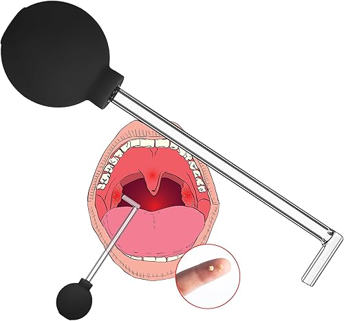 Miniatura 1 de TrelaCo Herramienta de extracción de piedra de amígdala, tubo de vidrio, herramienta de ventosas de piedra de amígdala, removedor de piedra de