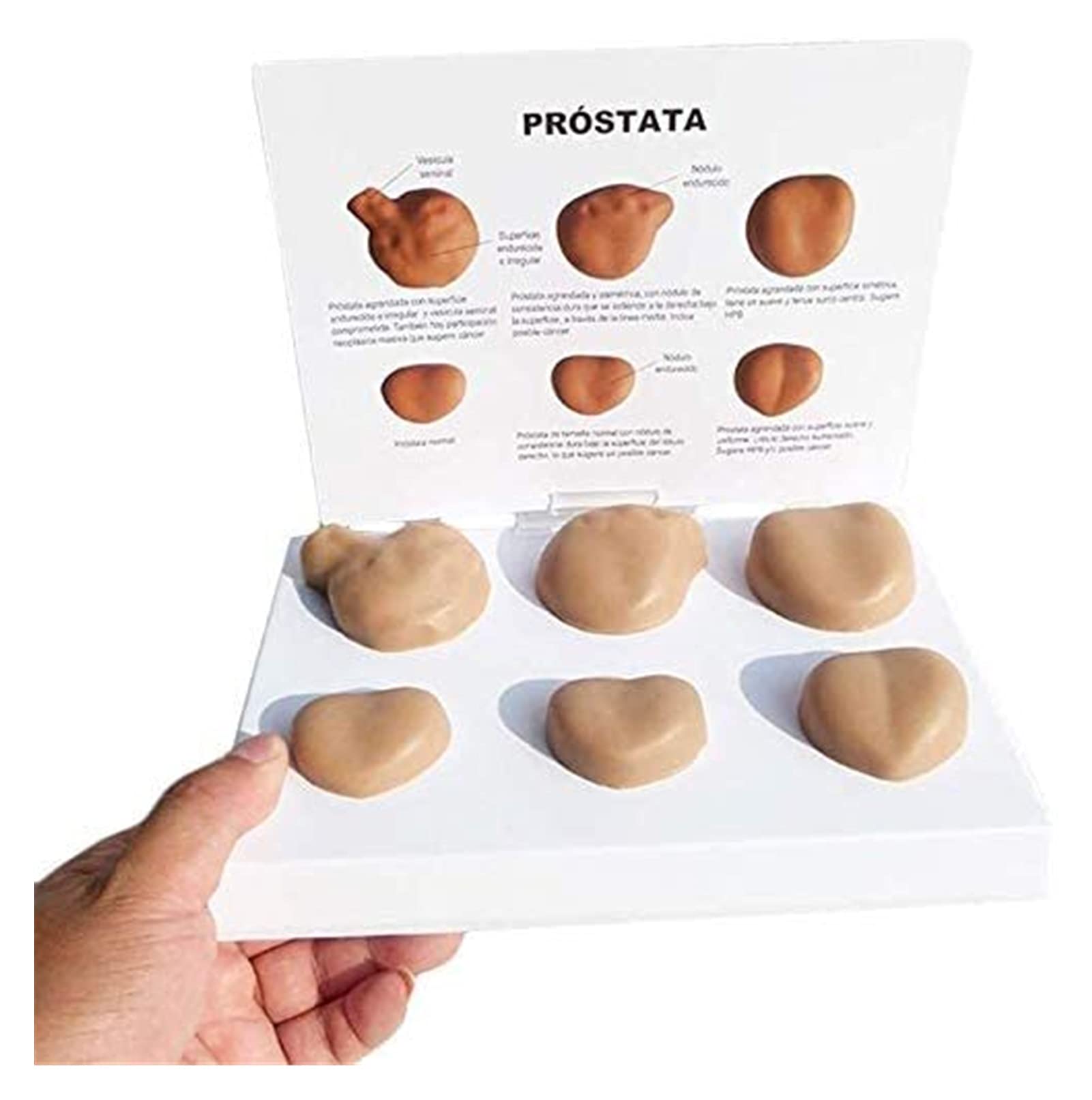 Modelo anatomía, Modelo órgano Humano Masculino Contraste patológico patológico próstata - Estudio enseñanza Modelo órgano médico Modelo Esqueleto