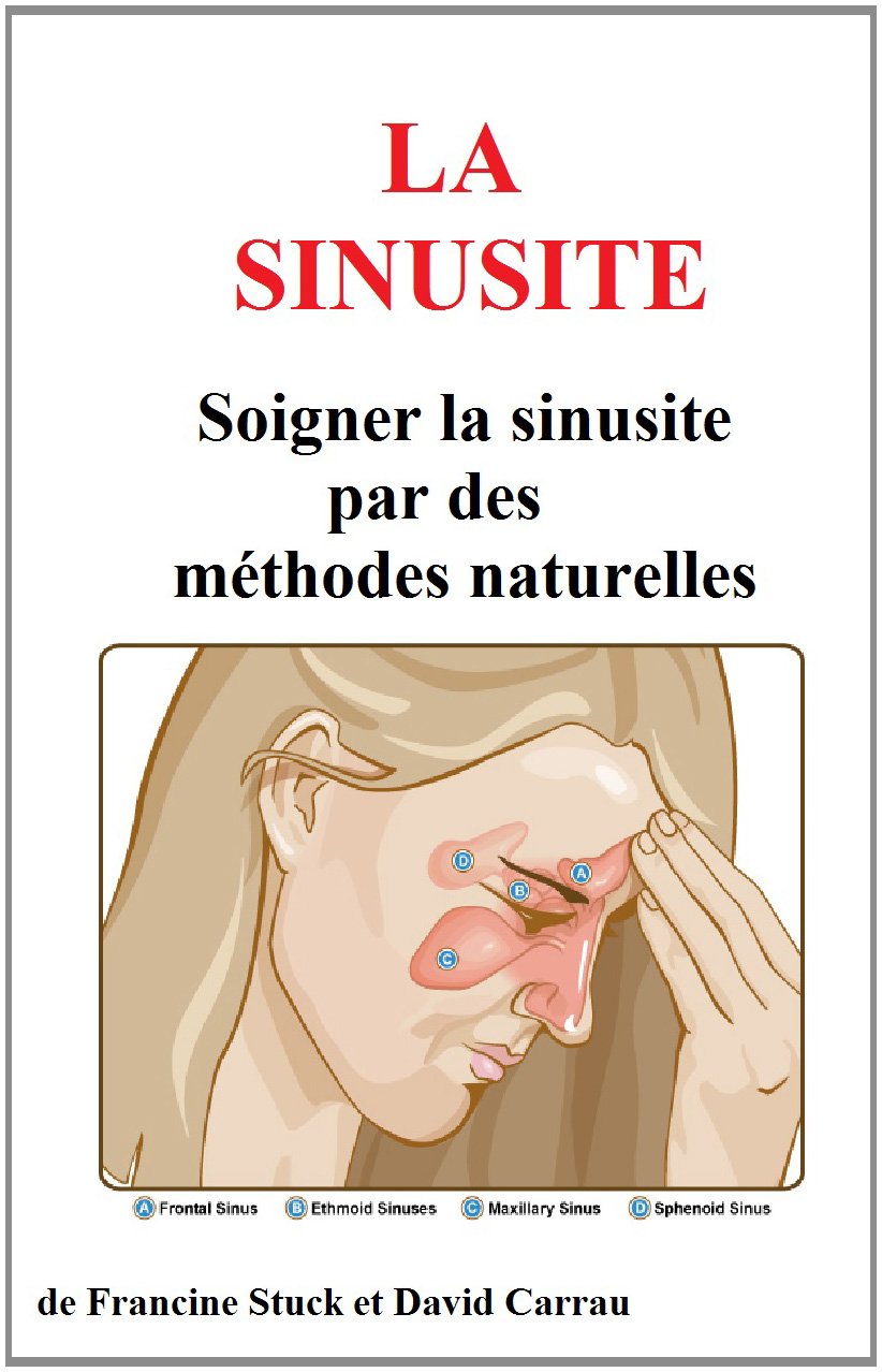 Sinusite et Maux de Tête Traitements Naturels pour soigner la — free download