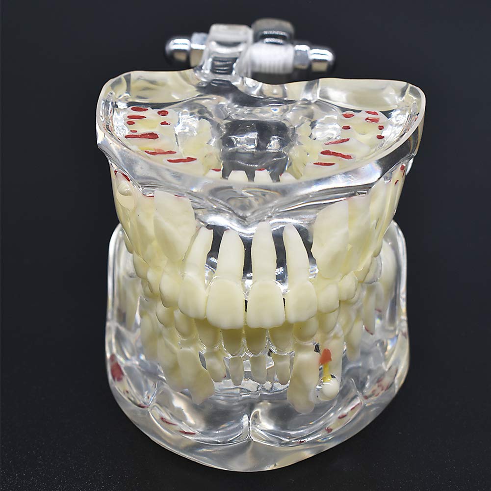 Angzhili Teeth Model Kids,Transparent Dental Demonstration Teeth Model,Typodont Teaching Model