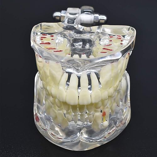 Miniatura 6 de Angzhili Modelo de dientes para niños,Modelo de dientes de demostración dental transparente,Modelo de enseñanza de Typodont