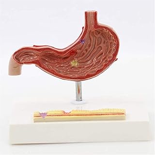Study Model Educational Model Life Size Stomach Anatomy Model Human Organ Anatomical Model Medical Anatomical Pathological Stomach Model for Study Display Teaching Model,Medical Models SaiFei
