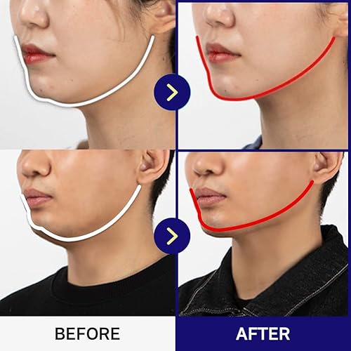 Miniatura 6 de Mevving - Entrenador de lengua - Reductor de doble barbilla  Removedor de doble barbilla I V Line Lifting I Productos de belleza para el cuidado