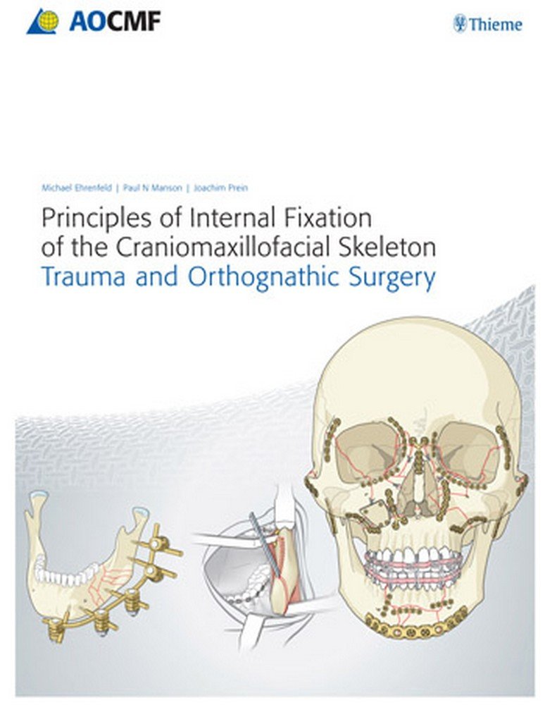 Buy Principles of Internal Fixation of the