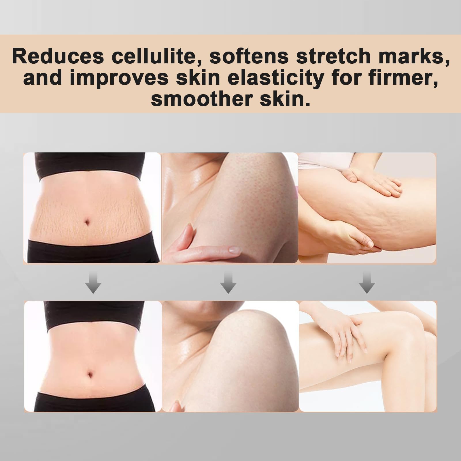 Lymphdrainage Massagegerät & Anti Cellulite Massage, SINZONeu® Wiederaufladbare Körper Massagegerät mit Wärme, Rotlicht, Vibration für Beine, Arme, Bauch，Blassgelb