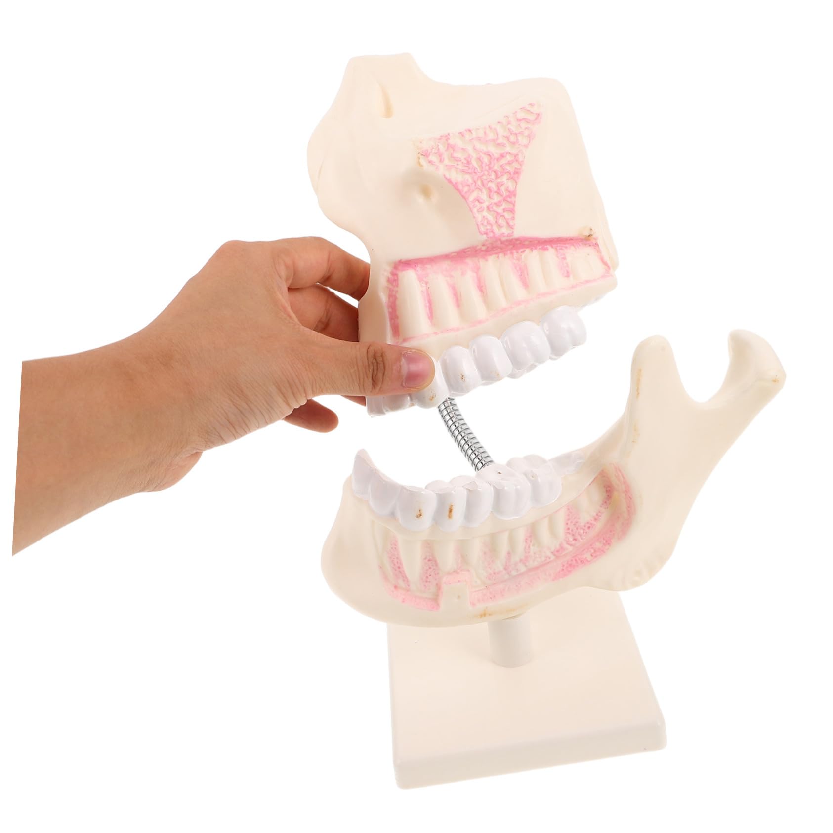 Overdenture Modell Kieferorthopädisches Übungsmodell Zahnersatzreparatur Übungszahnmodell Dekor Skulptur Zahnschnitz Trainingsmodell Zahnschnitz Übungsmodell Kunststoff