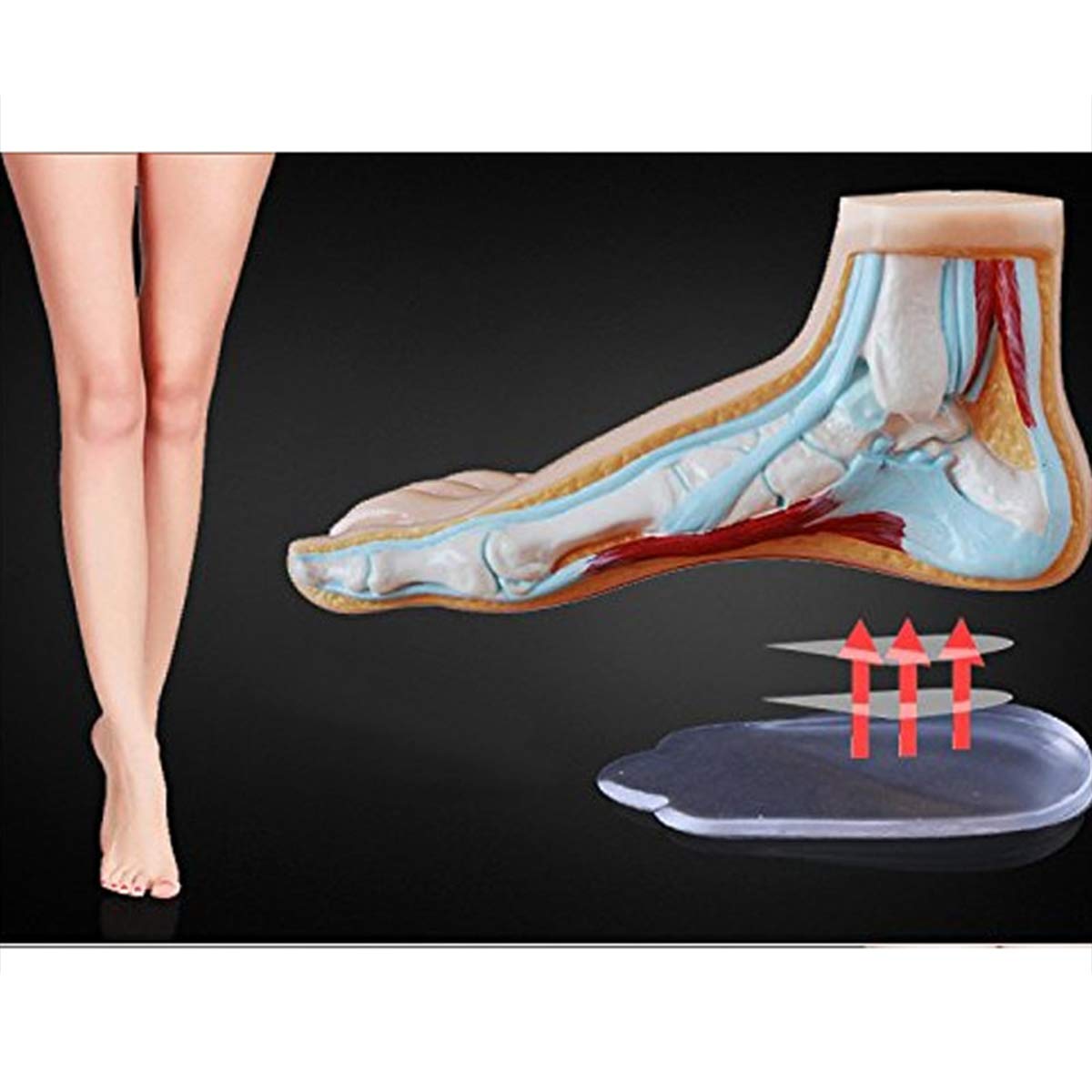 Buy Medial & Lateral Heel Wedge Silicone Insoles (Pair), Posture