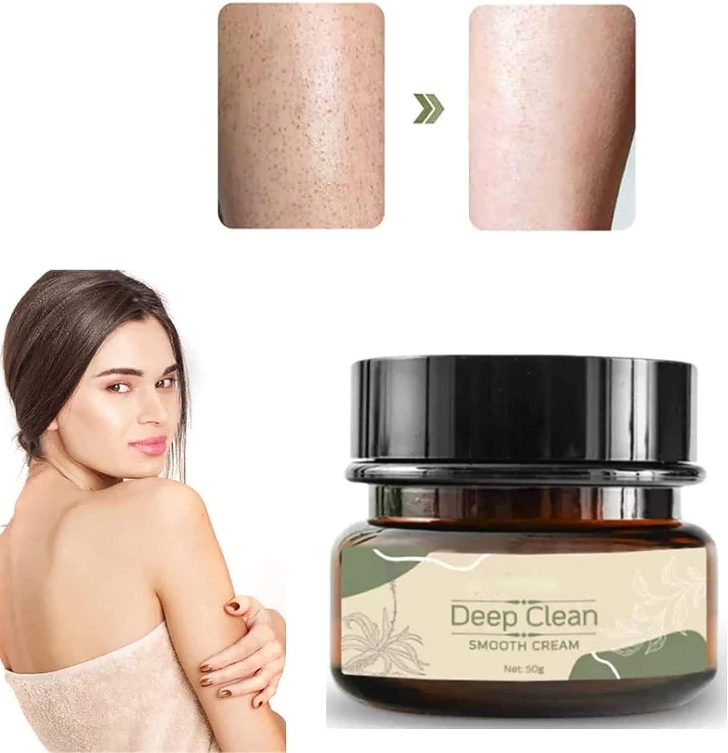 Generic Keratosis Treat Deep Clean Smooth Cream, Keratosis Cream