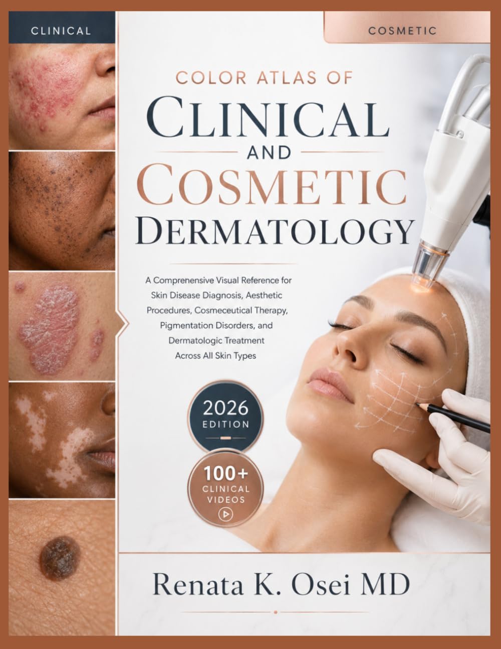 Color Atlas of Clinical and Cosmetic Dermatology: A Comprehensive Visual Reference for Skin Disease Diagnosis, Aesthetic Procedures, Cosmeceutical Therapy, Pigmentation Disorders, and Dermatologic