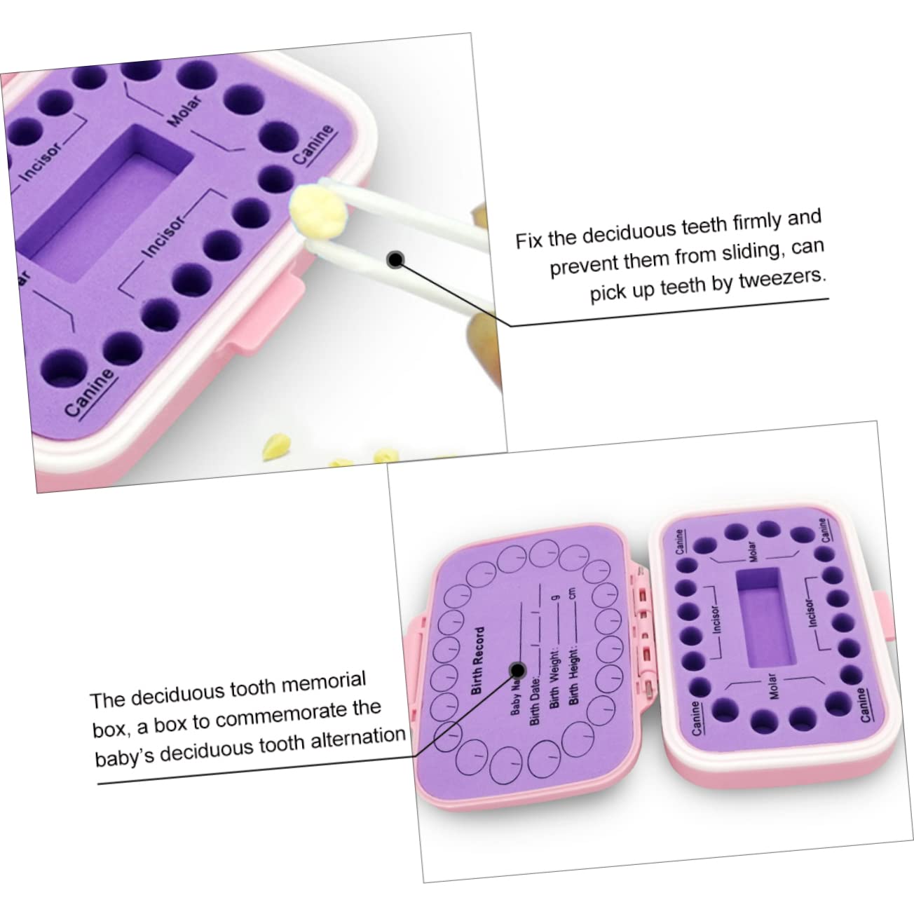 TOYANDONA Caja De 2 Piezas Caja De De Leche Organizador De Almacenamiento De Caja De Memoria Dental Primeros Niño Pequeño Lindo Páginas Bandeja De Almacenamiento