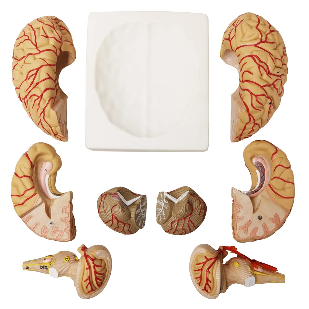Snapklik.com : Evotech Human Brain Model w/Arteries, 9 Parts Life Size ...