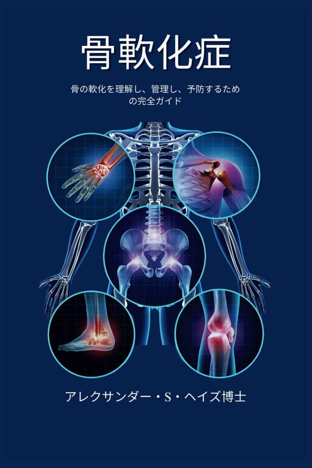 Amazon.co.jp: 骨軟化症: 骨の軟化を理解し、管理し、予防するための