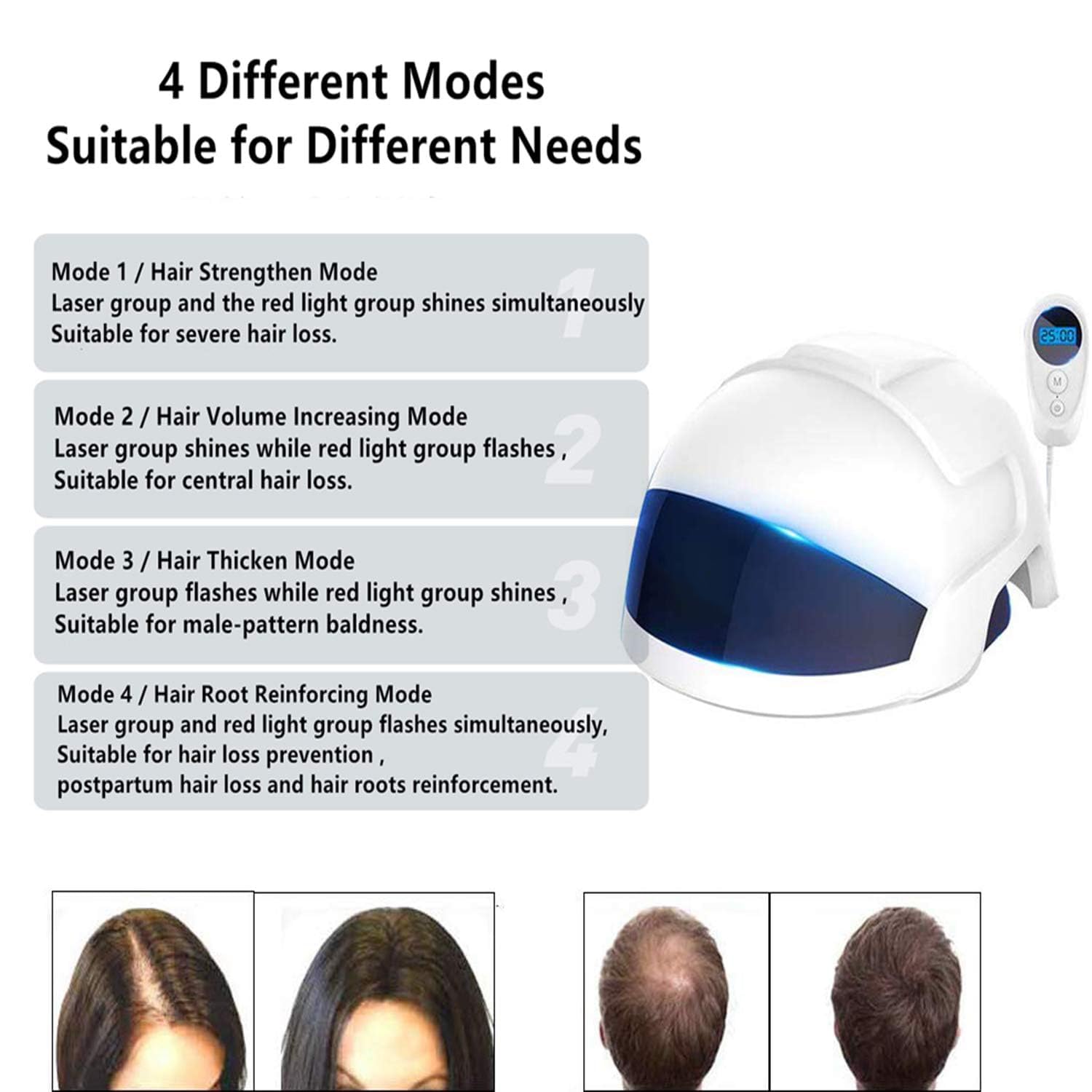 KEYOZA Anti Hair Loss Device Hair Growth Laser Helmet Hair Care Device for Men & Women Prevent Hair Loss, FDA Certified, No Side Effects - Image 9 thumbnail