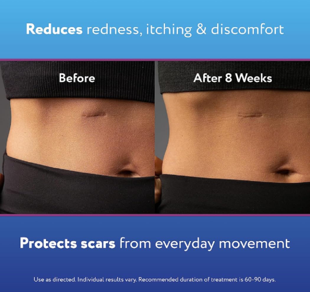 Advanced Silicone Scar Gel Scar Cream,Clear Professional Scar Removal Cream for Surgical Scars, Old and New Scar,(30g), 1 Ounce.