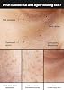 Celimax Pore+Dark Spot Brightening Cream 35ml / Stain Cream