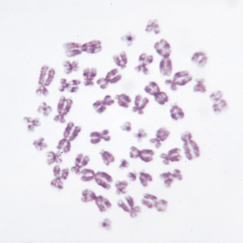 Human Female Chromosomes - 46, Xx, Spread Microscope Slide